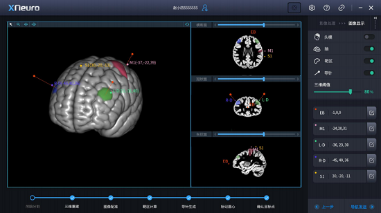 四川哪里看癲癇比較好?癲癇發作時會造成哪些危害啊?